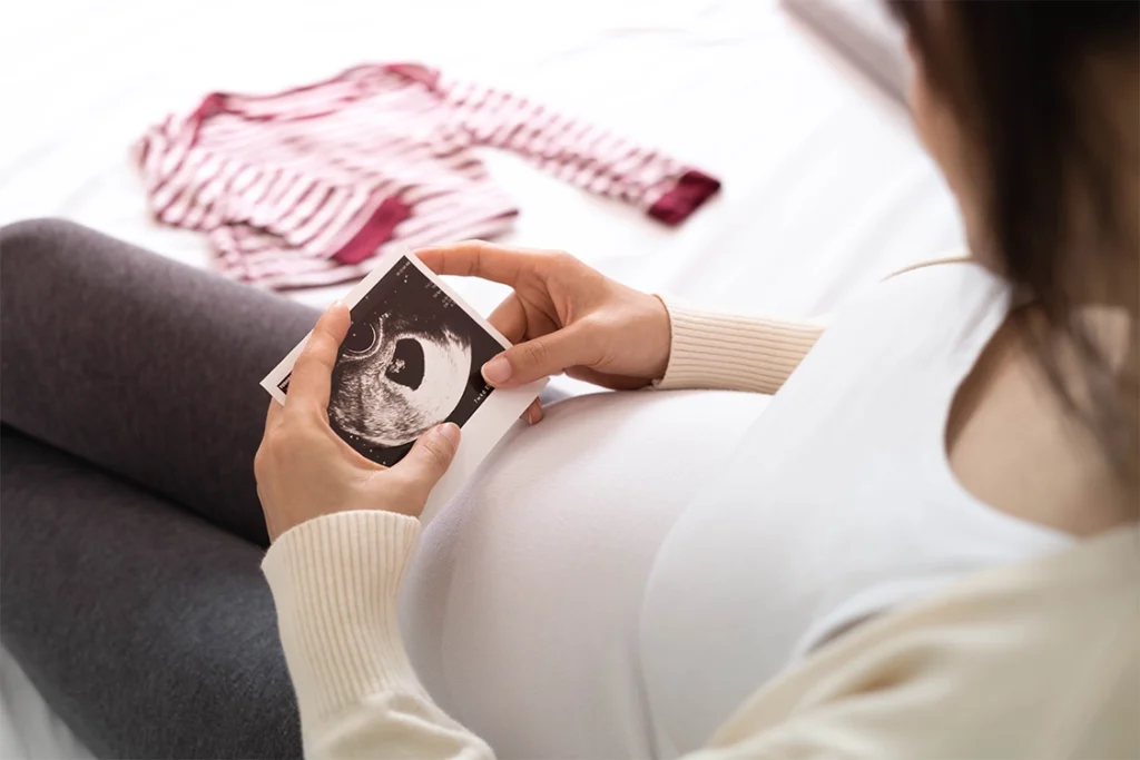Pregnancy Scan
